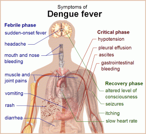 Dengue_fever_treatment